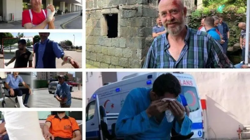 'Acemi kasap' tablosu: Bayramın ilk günü kaç kişi acil servise gitti?