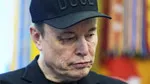 Elon Musk'ın Gözündeki Morluğun Sırrı Ne? Şok Açıklama!